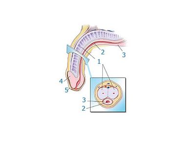 Сохтори penis