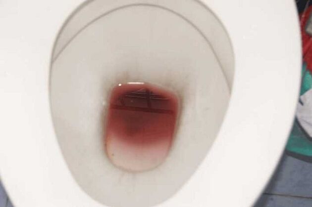 дар мардон ҳангоми ҳаяҷон пайдо шудан